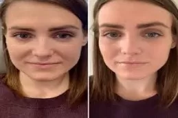 Cosmetic Injectables Clinic in Dubai