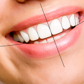 Digital Smile Design Cost in Dubai & Abu Dhabi