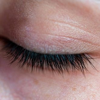 Eyelash Pubic Hair Transplant in Dubai & Abu Dhabi