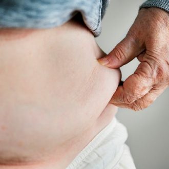 Gastric Sleeve Surgery Dubai Cost