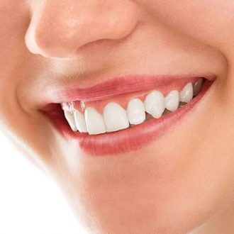 Gummy Smile Treatment Cost in Dubai & Abu Dhabi