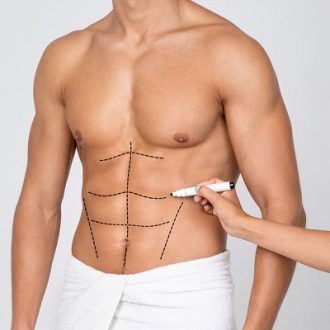 How Much Weight Do you Lose with Liposuction in Dubai