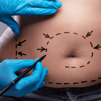 Liposonix Treatment Cost in Dubai & Abu Dhabi