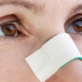 Nose Surgery for Broken Nose in Dubai & Abu Dhabi