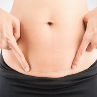 Post Surgical Scar Removal Cost Dubai & Abu Dhabi