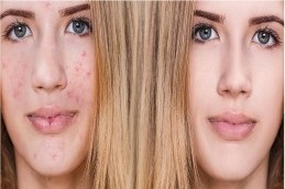 Skin Care Treatment in Dubai