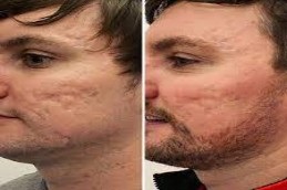 Skin Care in Dubai Abu Dhabi