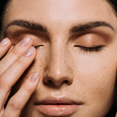 What is the Most Effective Treatment for Melasma?