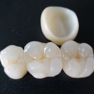 Zirconia Crown Cost in Dubai & Abu Dhabi