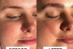 Best brow-lamination Clinic in Dubai