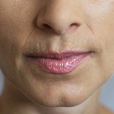 Dermal Fillers for Smokers Lines Dubai & Abu Dhabi Price & Cost