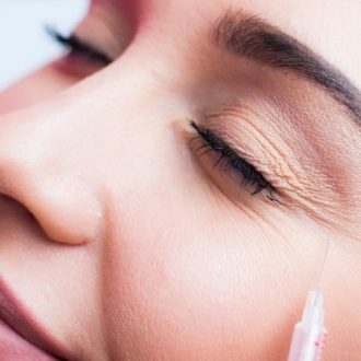 Does Botox Work for Wrinkles Around the Mouth?