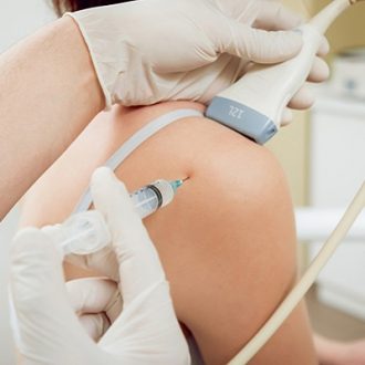 PRP Injection for Rotator Cuff Tear in Dubai