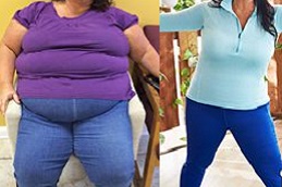 best post-weight-loss-cost in dubai