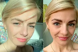 brow-lamination Clinic in Dubai