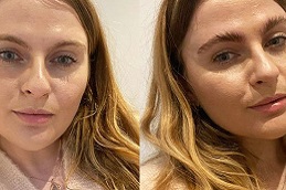 brow-lamination in dubai