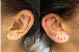 ear-piercing-cost in Abu Dhabi