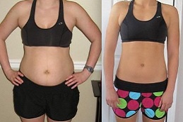 post-weight-loss-cost Clinic in Dubai