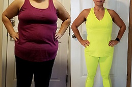 post-weight-loss-cost in Abu Dhabi