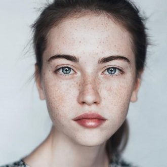 Best Dermatologist in Dubai for Pigmentation