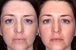 Best dermatologist for-pigmentation in Abu Dhabi
