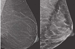 Best how-much-does-a-mammogram-cost Clinic in Dubai