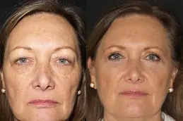 Best makeover-cosmetic-surgery-cost in Abu Dhabi