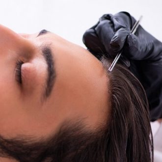 Biofibre Hair Transplant in Dubai & Sharjah
