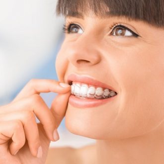 Invisible Braces Cost in Dubai & Abu Dhabi