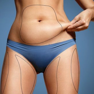 Mini Liposuction Surgery in Dubai & Abu Dhabi