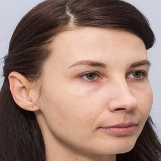 Redermalization Treatment Cost in Dubai