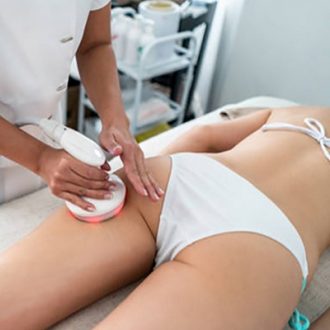 Should I Get Laser Hair Removal on My Butt?