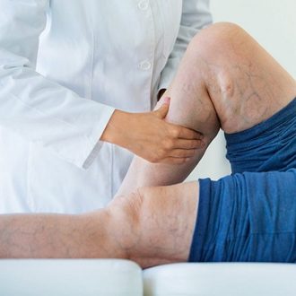 Spider Veins Removal Treatment Pros and Cons