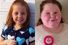 bariatric-surgery-for-childhood-obesity in Abu Dhabi