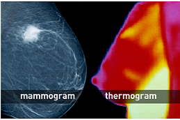 Breast Cancer Screening Cost in Dubai