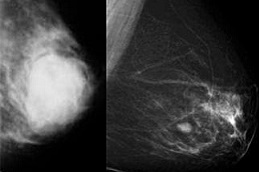 best how-much-does-a-mammogram-cost in dubai