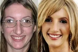 best makeover-cosmetic-surgery-cost in dubai
