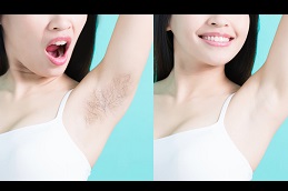 can-you-go-swimming-after-getting-laser-hair-removal in dubai