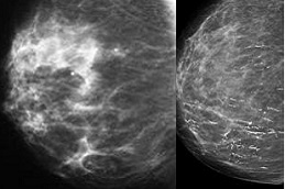 how-much-does-a-mammogram-cost Clinic in Dubai