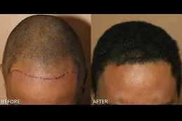 how-to-choose-the-best-hair-specialist Clinic in Dubai