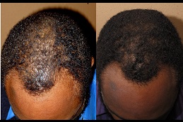 how-to-choose-the-best-hair-specialist Clinic in Dubai & abu dhabi