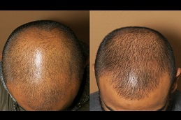 how-to-choose-the-best-hair-specialist in Abu Dhabi & Sharjah