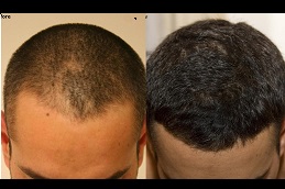 how-to-choose-the-best-hair-specialist in Abu Dhabi