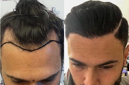 how-to-choose-the-best-hair-specialist-in-dubai