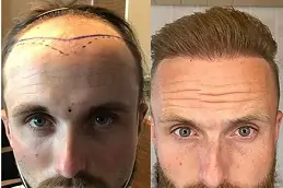 how-to-choose-the-hair-specialist- in dubai