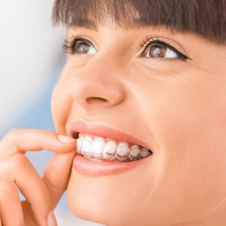 Aligners Cost in Dubai & Abu Dhabi
