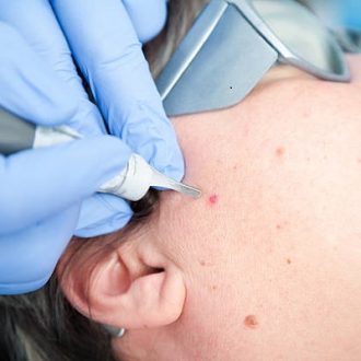 Best Laser Treatment Center in Dubai & Abu Dhabi