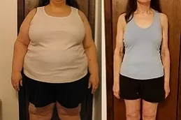 Best Slimming Surgeries Clinic in dubai & Abu Dhabi