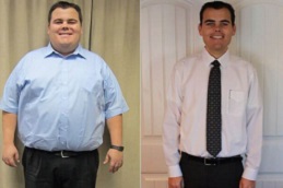 Best Slimming Surgeries in dubai
