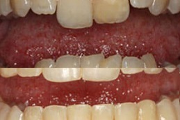 Best dental-activators-cost Clinic in Dubai